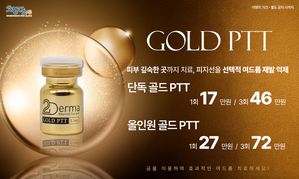 골드PTT